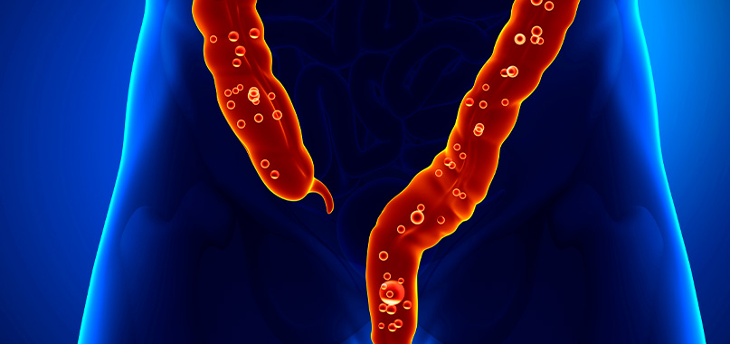 anaisa-portes-imagem-interna-cancer-de-reto