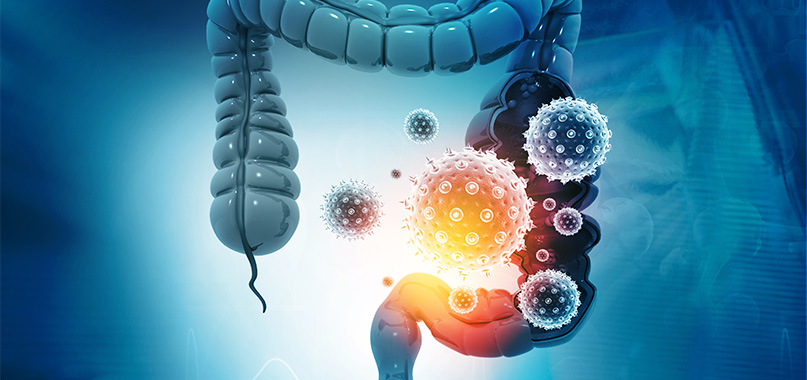 anaisa-portes-imagem-interna-cancer-do-trato-gastrointestinal